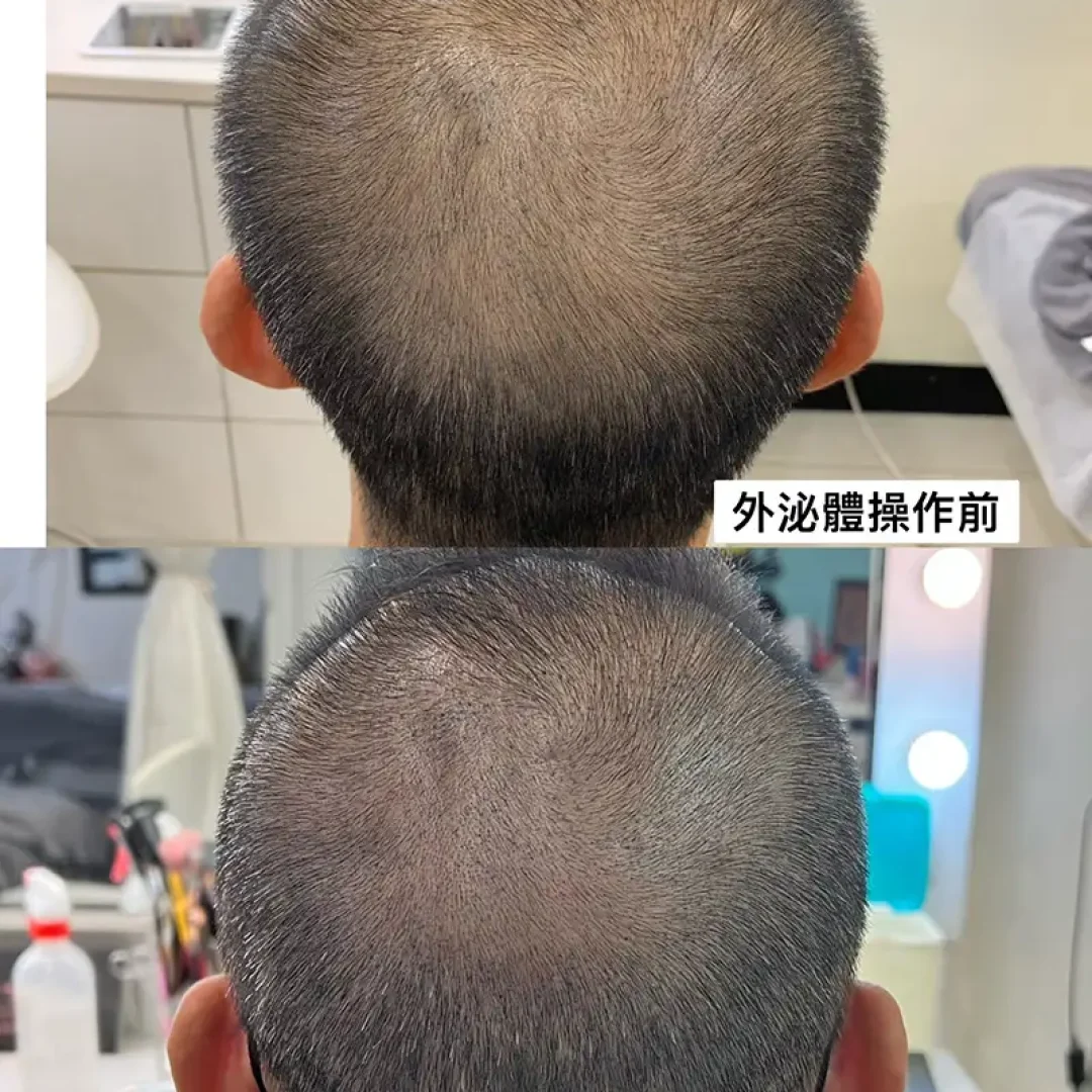 舞妝美睫紋繡美學-台北東區霧眉-台北美睫美瞳線-台北東區霧唇推薦_240930_projects_外泌體育髮_01