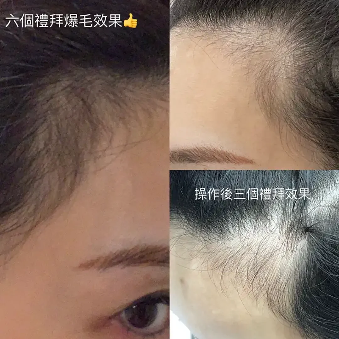 舞妝美睫紋繡美學-台北東區霧眉-台北美睫美瞳線-台北東區霧唇推薦_240930_projects_外泌體育髮_02