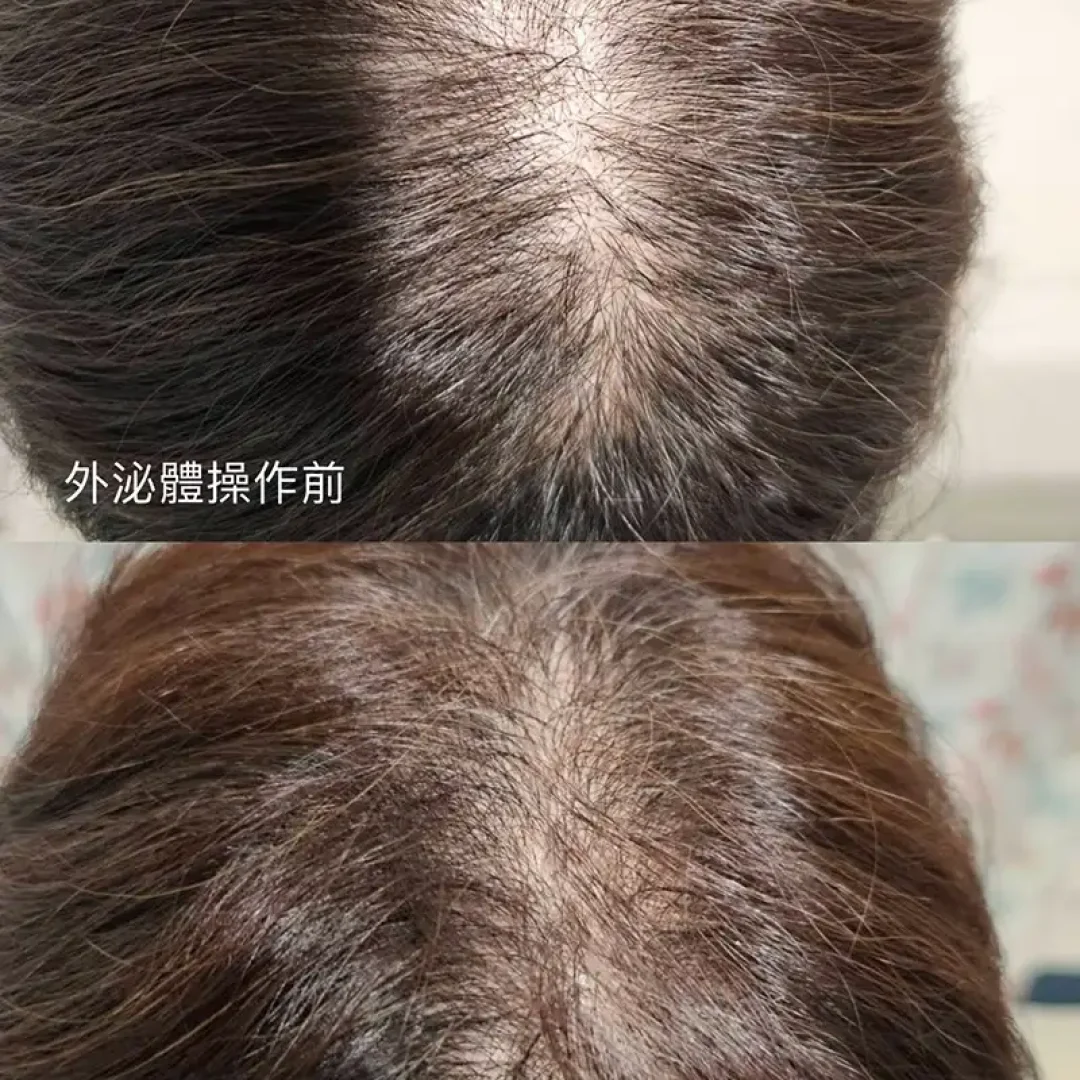 舞妝美睫紋繡美學-台北東區霧眉-台北美睫美瞳線-台北東區霧唇推薦_240930_projects_外泌體育髮_03