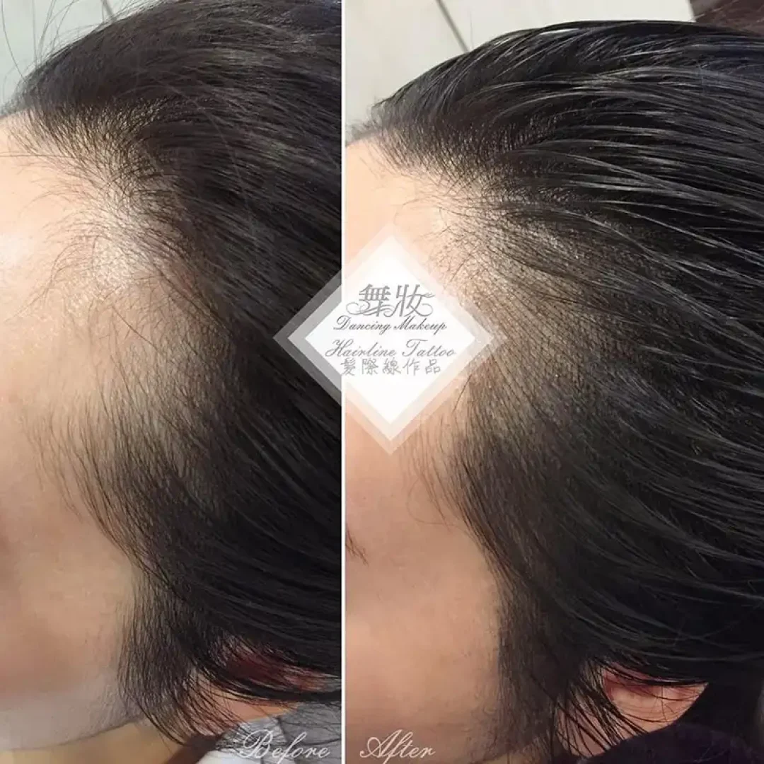 舞妝美睫紋繡美學-台北東區霧眉-台北美睫美瞳線-台北東區霧唇推薦_240930_projects_髮際線_01
