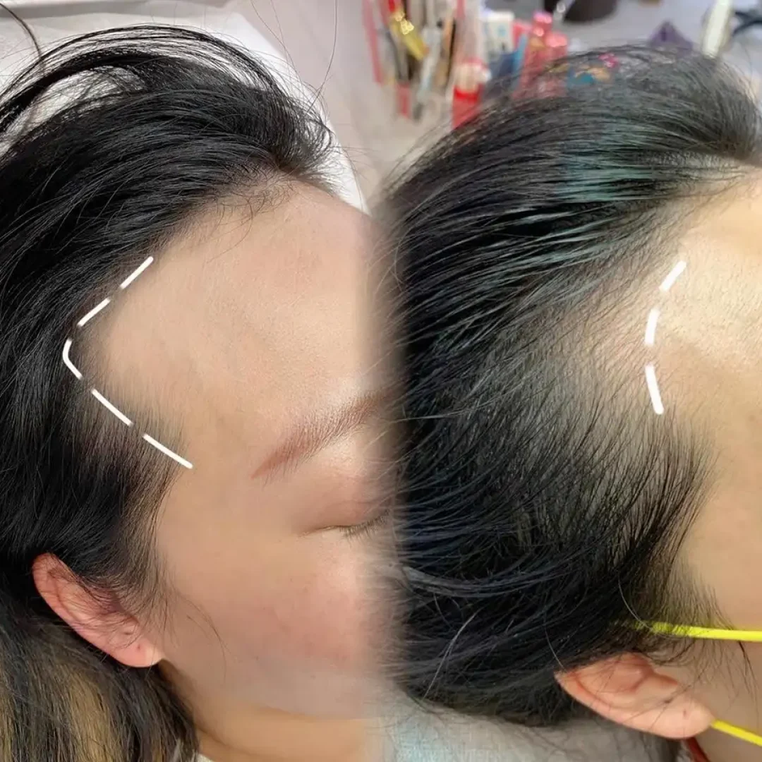 舞妝美睫紋繡美學-台北東區霧眉-台北美睫美瞳線-台北東區霧唇推薦_240930_projects_髮際線_02