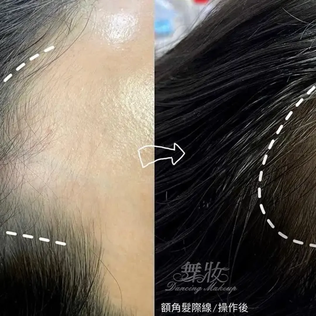 舞妝美睫紋繡美學-台北東區霧眉-台北美睫美瞳線-台北東區霧唇推薦_240930_projects_髮際線_03