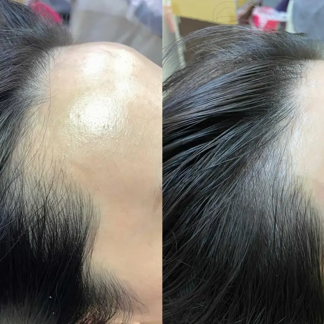 舞妝美睫紋繡美學-台北東區霧眉-台北美睫美瞳線-台北東區霧唇推薦_240930_projects_髮際線_07